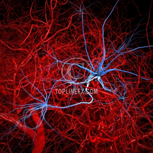 Fantasy cancerous metastasis